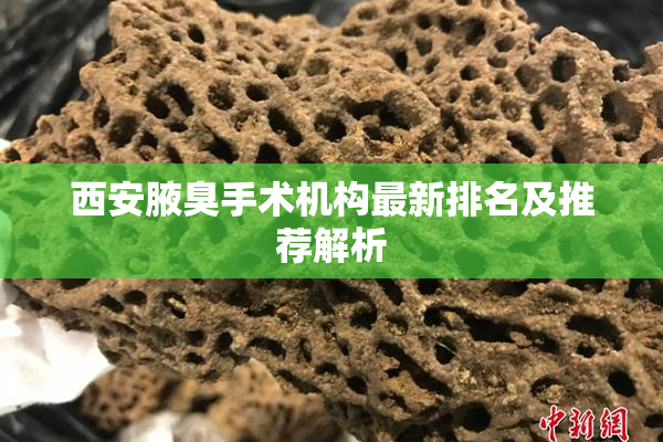 西安腋臭手术机构最新排名及推荐解析