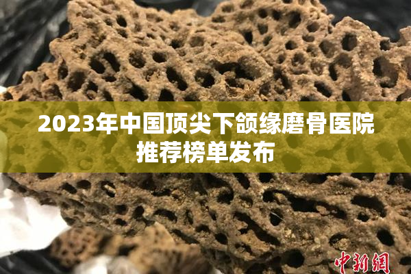 2023年中国顶尖下颌缘磨骨医院推荐榜单发布